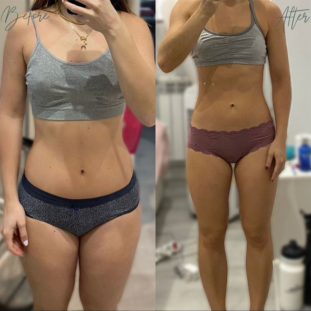 Transformation 2